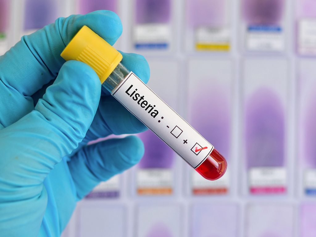 Read more on Understanding the updated Listeria Policy (Canada)